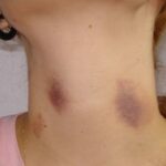 Est-ce que le litchi est dangereux ?