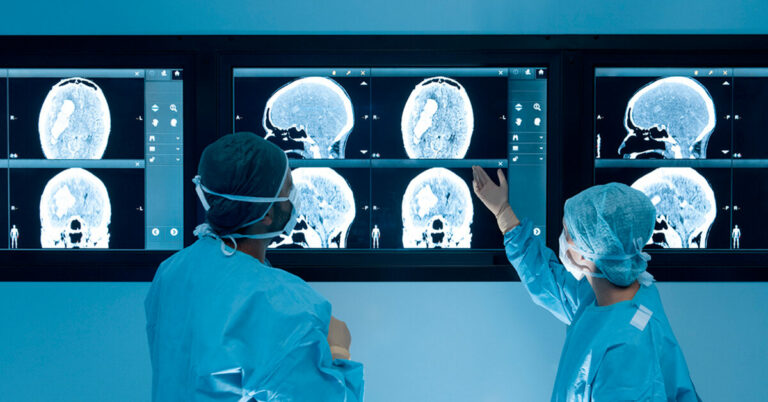 La recherche montre ce qui arrive à notre cerveau lorsque nous changeons d’avis