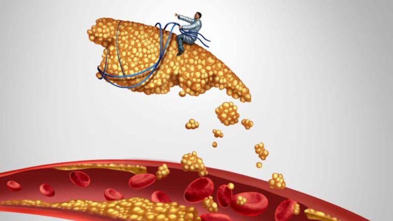 8 aliments et boissons qui réduisent efficacement le cholestérol !