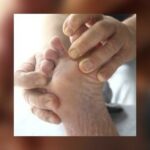 Comment Appelle-t-on la maladie entre les orteils ?