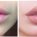Comment avoir des lèvres plus petites ?