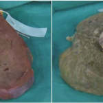 Comment cuire le foie pour bébé ?