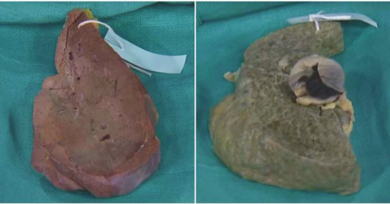 Comment cuire le foie pour bébé ? Comment cuire le foie pour bébé ?