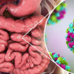 Comment de temps dure une gastro ?