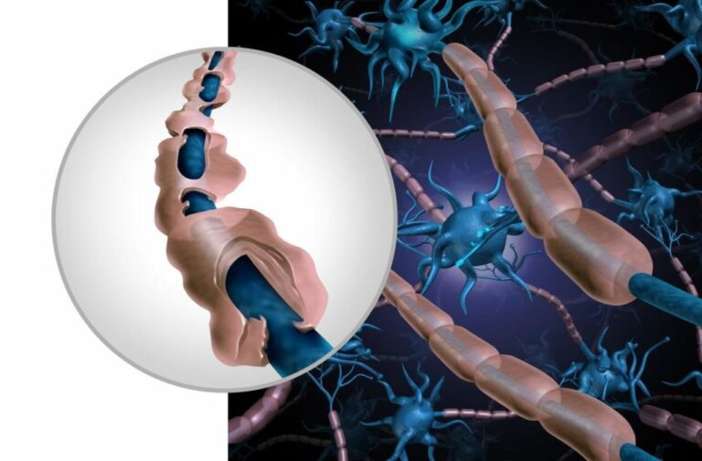 Comment détecter la listériose ?