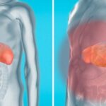 Comment éliminer la graisse du foie naturellement ?