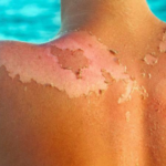 Comment enlever la peau des mandarines ?