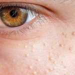 Comment enlever la petite peau des oranges ?