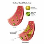 Comment faire baisser le cholestérol méthode de Grand-mère ?