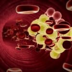 Comment faire baisser rapidement son taux de cholestérol ?