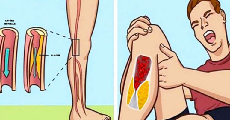 Comment fluidifier le sang naturellement ?