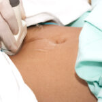 Comment reconnaître la fatigue de grossesse ?