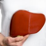 Comment réduire naturellement les graisses du foie ?