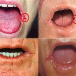 Comment remonter les coins de la bouche ?