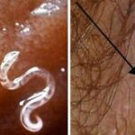 Comment savoir si on a trop de sel dans le corps ?