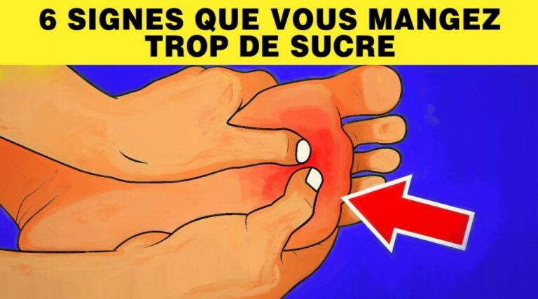 Comment savoir si on a trop de sucre dans le corps ? Comment savoir si on a trop de sucre dans le corps ?