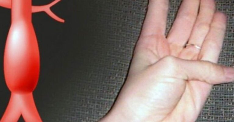 Comment savoir si on a une indigestion ?