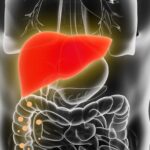 Comment savoir si on a une stéatose hépatique ?