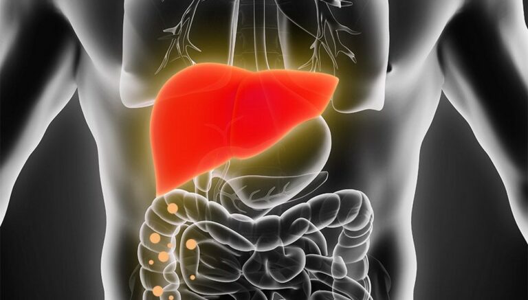 Comment savoir si on a une stéatose hépatique ?