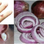 Comment soigner la prostate avec du jus de l'oignon ?