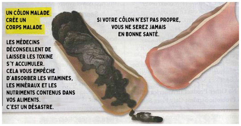 Comment tester le poison dans le corps ? Comment tester le poison dans le corps ?