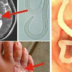 Comment tuer les vers dans le poisson ?