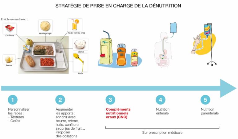 Stratégie de prise en charge de la dénutrition