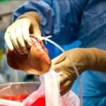 Est-ce grave d'avoir un foie gras ?