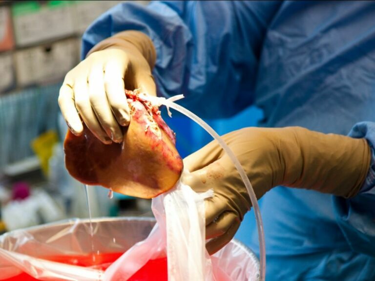 Est-ce grave d'avoir un foie gras ?