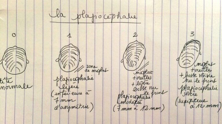 Est-ce que la tête plate se remet toute seule ? Est-ce que la tête plate se remet toute seule ?