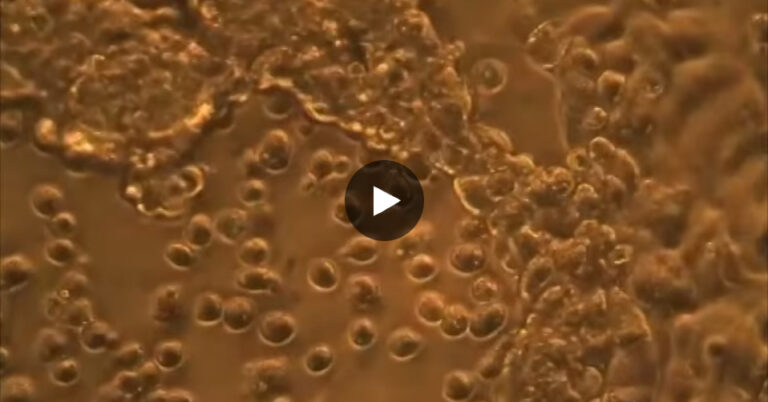 Est-ce que le chocolat tue les cellules cancéreuses ? Est-ce que le chocolat tue les cellules cancéreuses ?