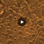 Est-ce que le chocolat tue les cellules cancéreuses ?