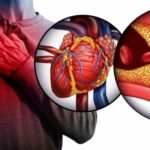 Est-ce que le cholestérol fatigue ?