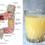 Est-ce que le citron est bon pour les intestins ?