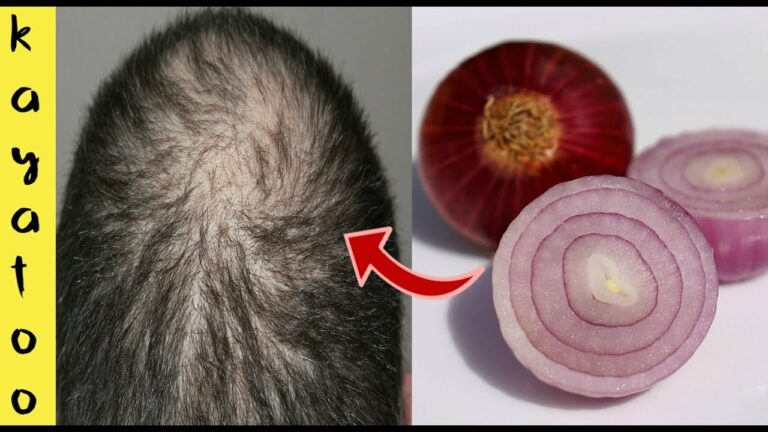 Est-ce que le jus d'oignon fait pousser les cheveux ?