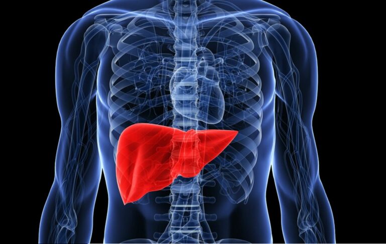 Est-ce que une stéatose du foie est réversible ? Est-ce que une stéatose du foie est réversible ?