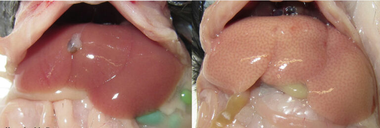 Est-ce qu'une stéatose est grave ?