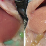 Est-ce qu'une stéatose est grave ?