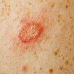 Fait-il Enlever la peau des champignons ?