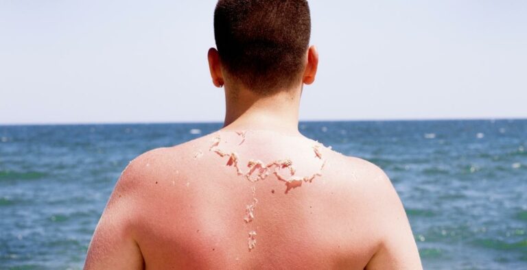 Pourquoi Faut-il Enlever la peau des champignons ? Pourquoi Faut-il Enlever la peau des champignons ?