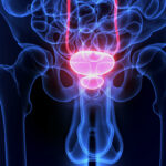 Pourquoi vider la prostate ?