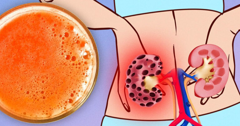 Quel est le meilleur aliment pour les reins ?