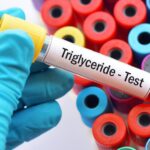 Quel est le taux dangereux de triglycérides ?