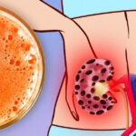 Quel fruit est bon pour la prostate ?