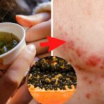 Quels sont les bienfaits des feuilles de radis ?