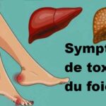 Quels sont les signes d'un mauvais fonctionnement du foie ?