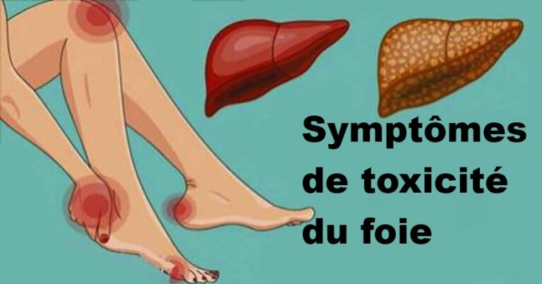 Quels sont les signes d'un mauvais fonctionnement du foie ?