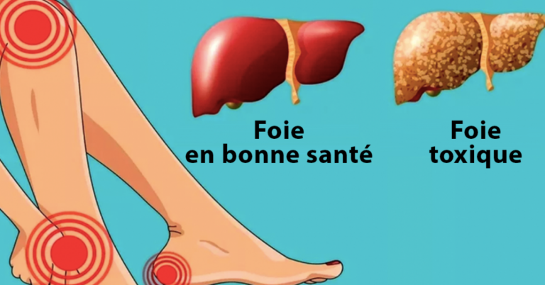 Quels sont les symptômes d'un foie fatigué ?