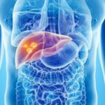 Quels sont les symptômes quand on a mal au foie ?