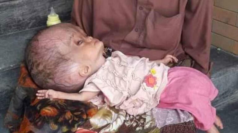 Qu’est-ce qu’un bébé de 7 mois peut manger ? Qu'est-ce qu'un bébé de 7 mois peut manger ?